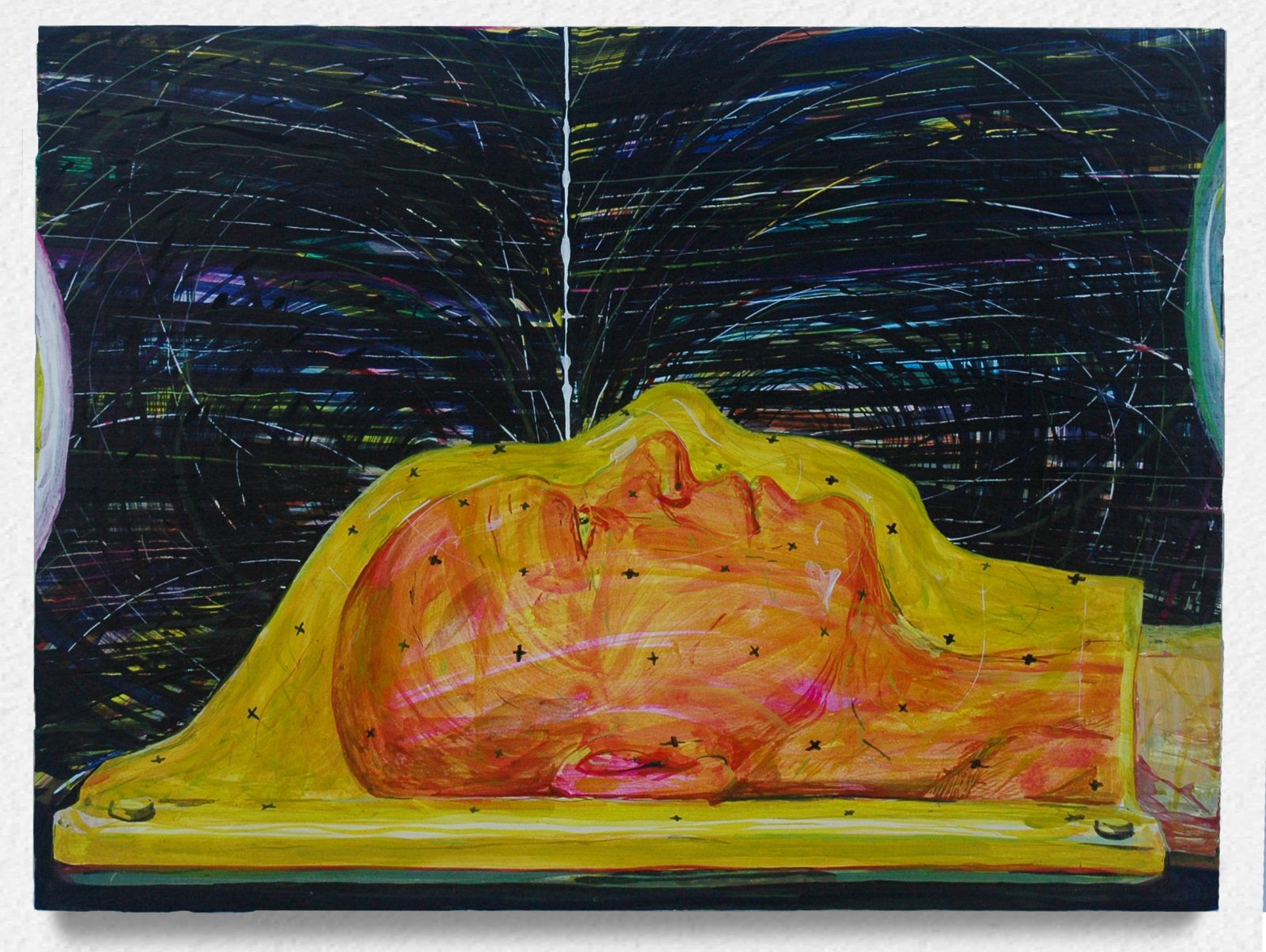 아만다 레치너 작가의 작품 'Radio Sugery Gamma Knife'.