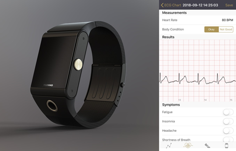 손목형 심전도 측정장치에 대한 규제가 풀렸다.