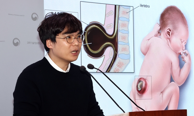 한국 연구진, 보행 장애 유발하는 척추이분증 원인 규명···세계 최초