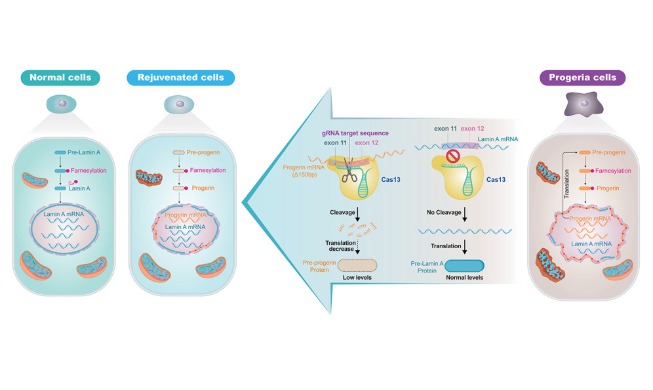 한국 연구팀, 조로증 유전자 제거 기술 세계 첫 개발